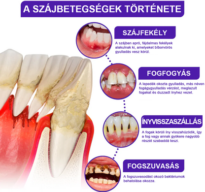 🌟A magyarok kedvence丨Rolimey® VioCore Méhméreg Fogkezelő Fogkrém