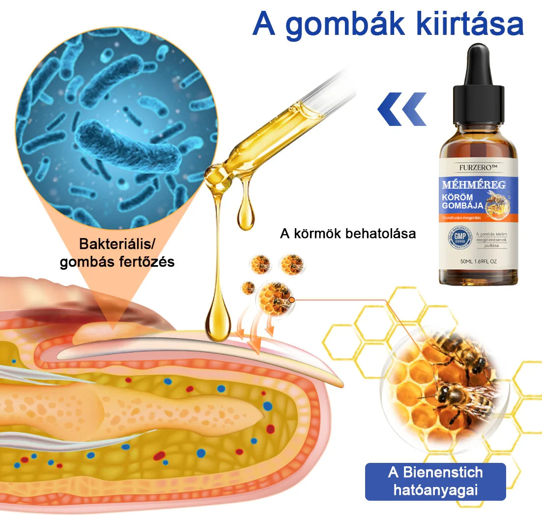 🐝Most 50% kedvezménnyel丨Furzero™ Méhméreg Körömgomba Kezelőoldat: Teljes megoldás a körömgomba problémájára🌟👣👣（Az utánvétes fizetést）