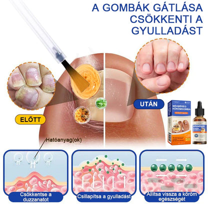 🐝Most 50% kedvezménnyel丨Furzero™ Méhméreg Körömgomba Kezelőoldat: Teljes megoldás a körömgomba problémájára🌟👣👣（Az utánvétes fizetést）