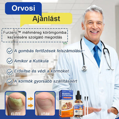 🐝Most 50% kedvezménnyel丨Furzero™ Méhméreg Körömgomba Kezelőoldat: Teljes megoldás a körömgomba problémájára🌟👣👣（Az utánvétes fizetést）