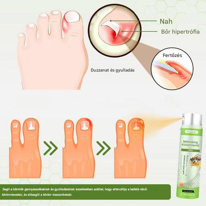 🔥A legnépszerűbb丨Korlátozott ideig 50%-os kedvezmény | Foulme® NailRescue Méhméreg Spray🐝